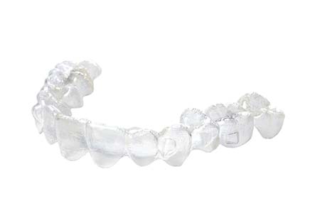 What To Ask Your Invisalign Dentist®