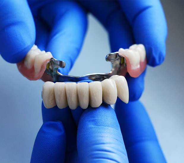 Stuart Dental Bridges