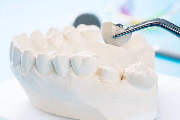 How Can A Dental Crown Safeguard Your Tooth?