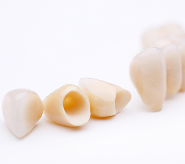 Stuart Dental Crowns