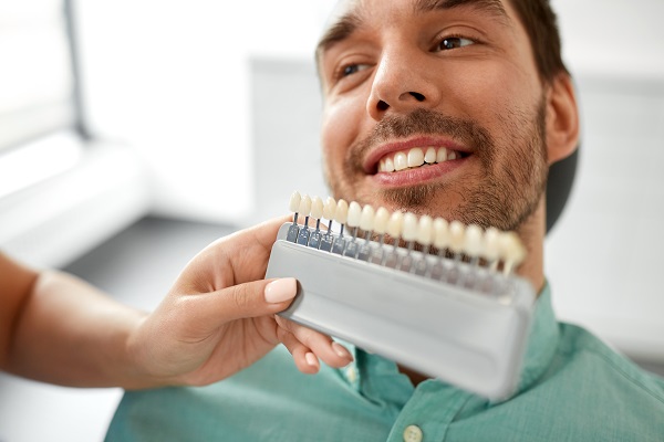 Dental Veneers: FAQs