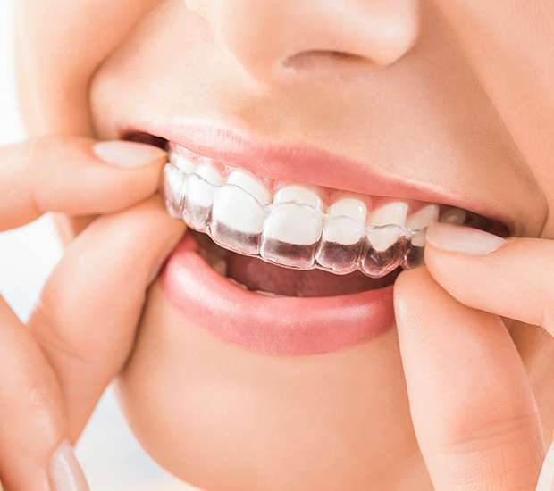 Stuart Does Invisalign® Really Work?