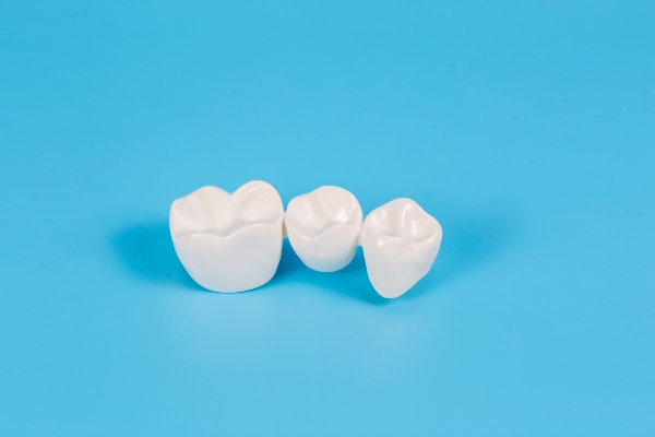 Exploring The Various Types Of Dental Bridges