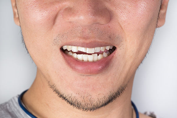 Can General Dentistry Repair A Knocked Out Tooth?
