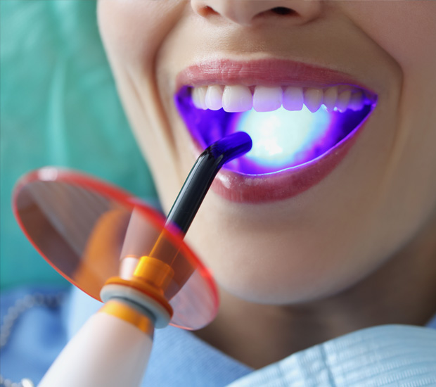 Stuart Hard-Tissue Laser Dentistry
