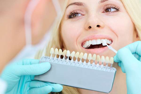 How A Cosmetic Dentist Places Dental Veneers