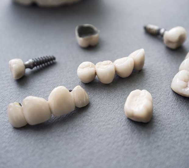 Stuart The Difference Between Dental Implants and Mini Dental Implants