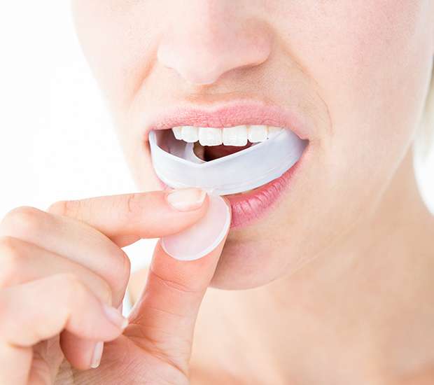 Stuart Mouth Guards