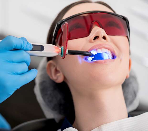 Stuart Professional Teeth Whitening