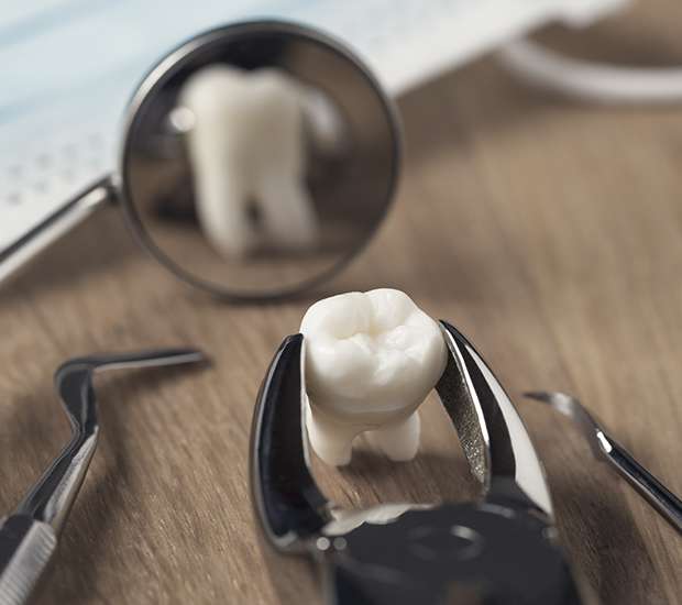 Stuart When Is a Tooth Extraction Necessary